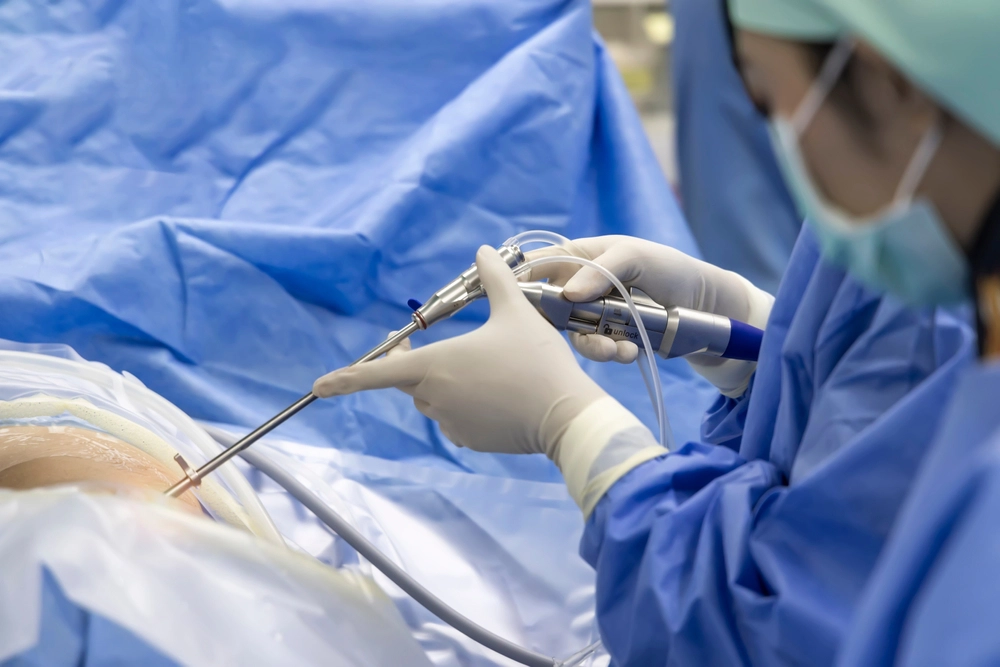 A young surgeon performing endoscopic spinal surgery on a patient